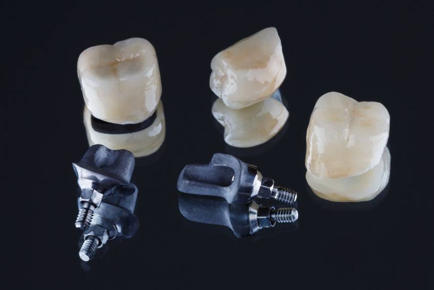 DentalX Downsview Dental Clinic/ Trusted Dentist what are dental crowns