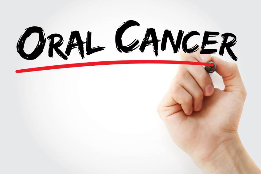 DentalX Downsview Dental Clinic/ Trusted Dentist oral cancer screening