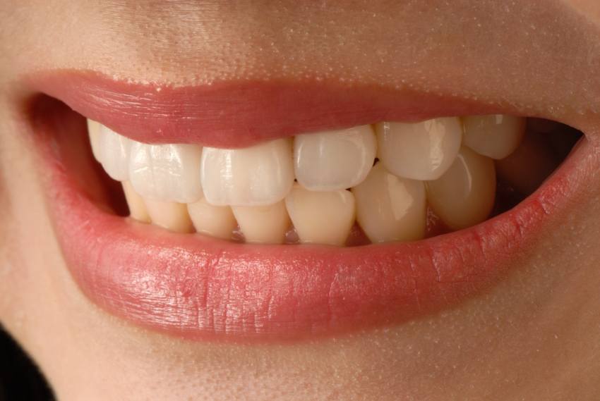 DentalX Downsview Dental Clinic/ Trusted Dentist Porcelian Veneers and Cosmetic Dentistry