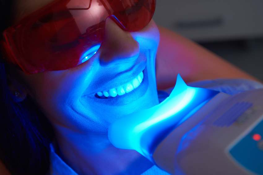 DentalX Downsview Dental Clinic/ Trusted Dentist teeth whitening benefits