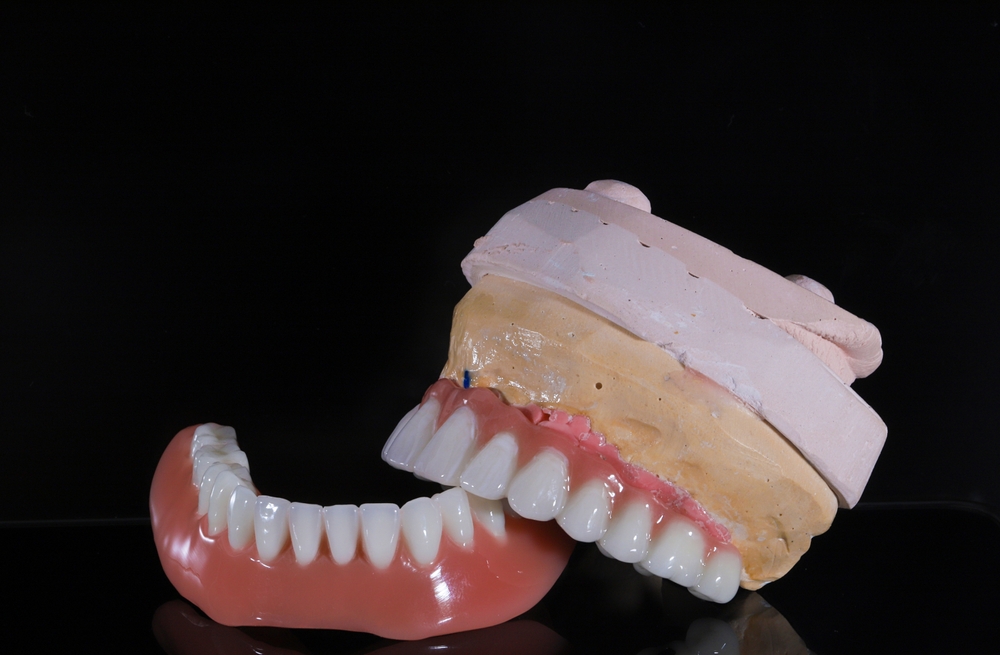 DentalX Downsview Dental Clinic/ Trusted Dentist what is a hybrid denture