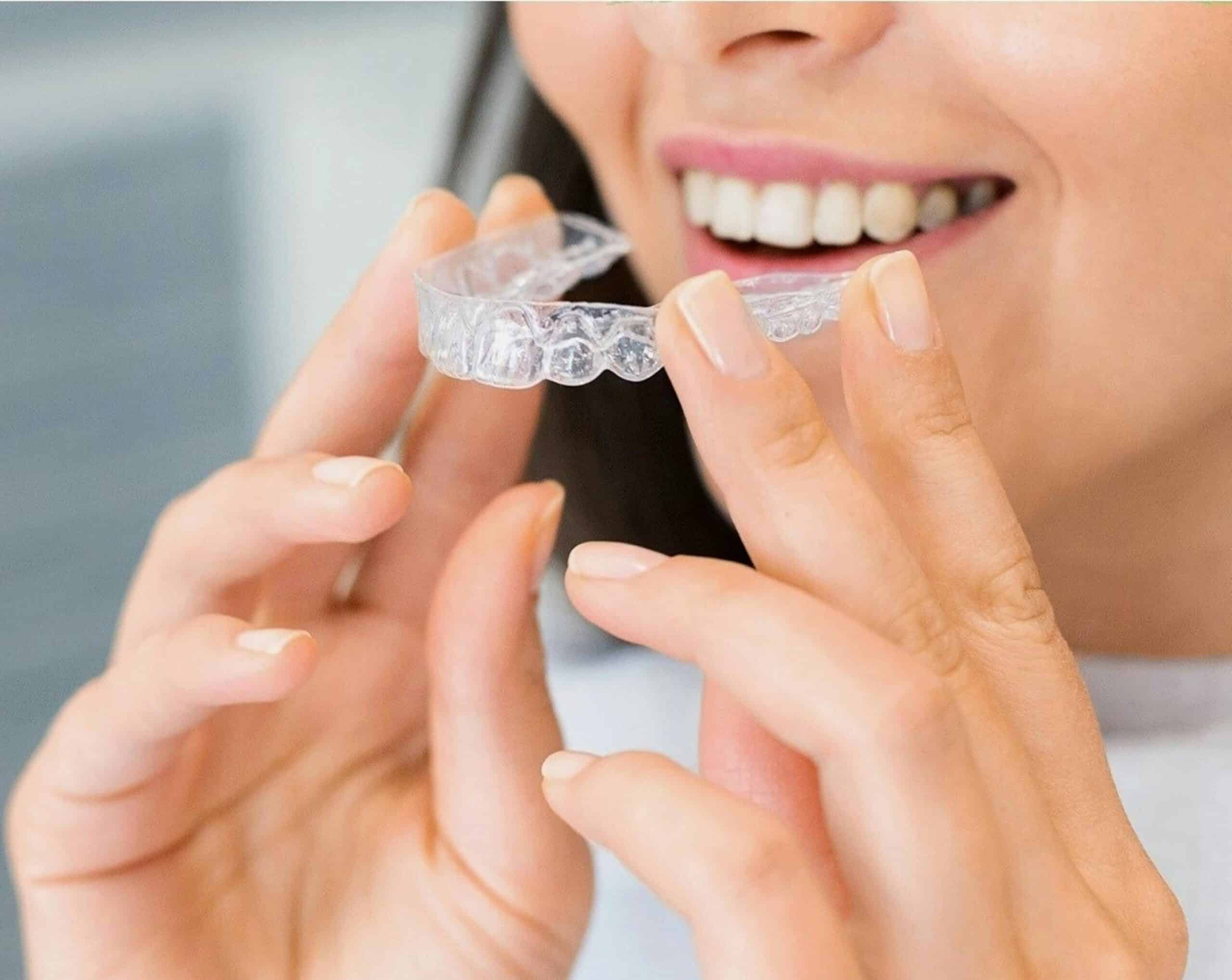 Invisible braces and Aligners /DentalX Downsview Dental Clinic