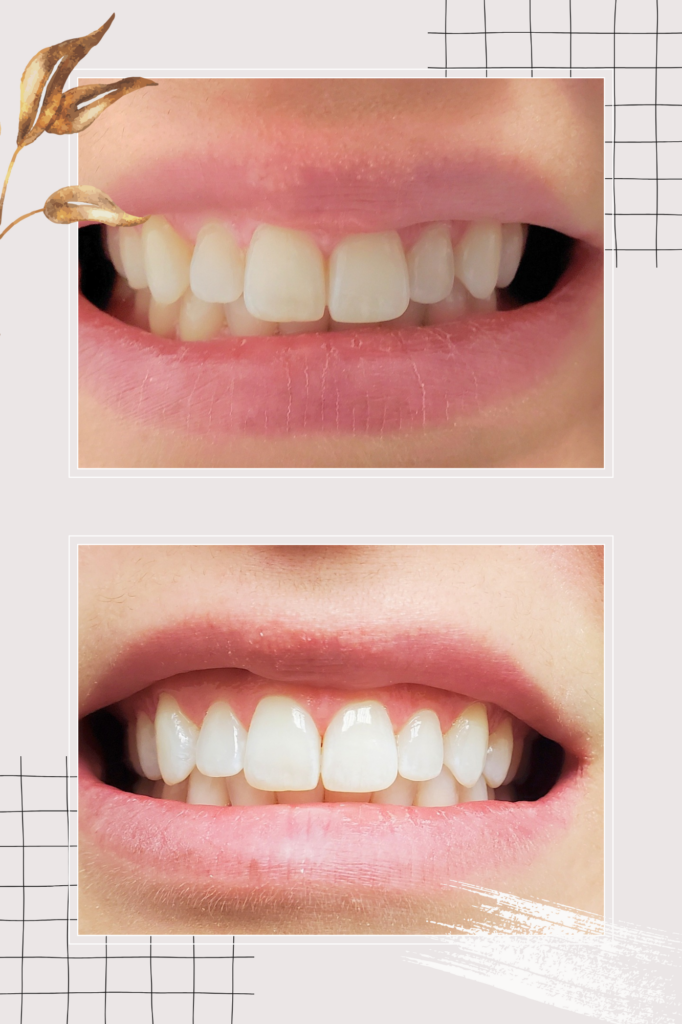 What Defines a Beautiful Smile? | DentalX Downsview Dental Clinic | DentalX Downsview Dental Clinic What defines a beautiful smile? DentalX Downsview Dental Clinic