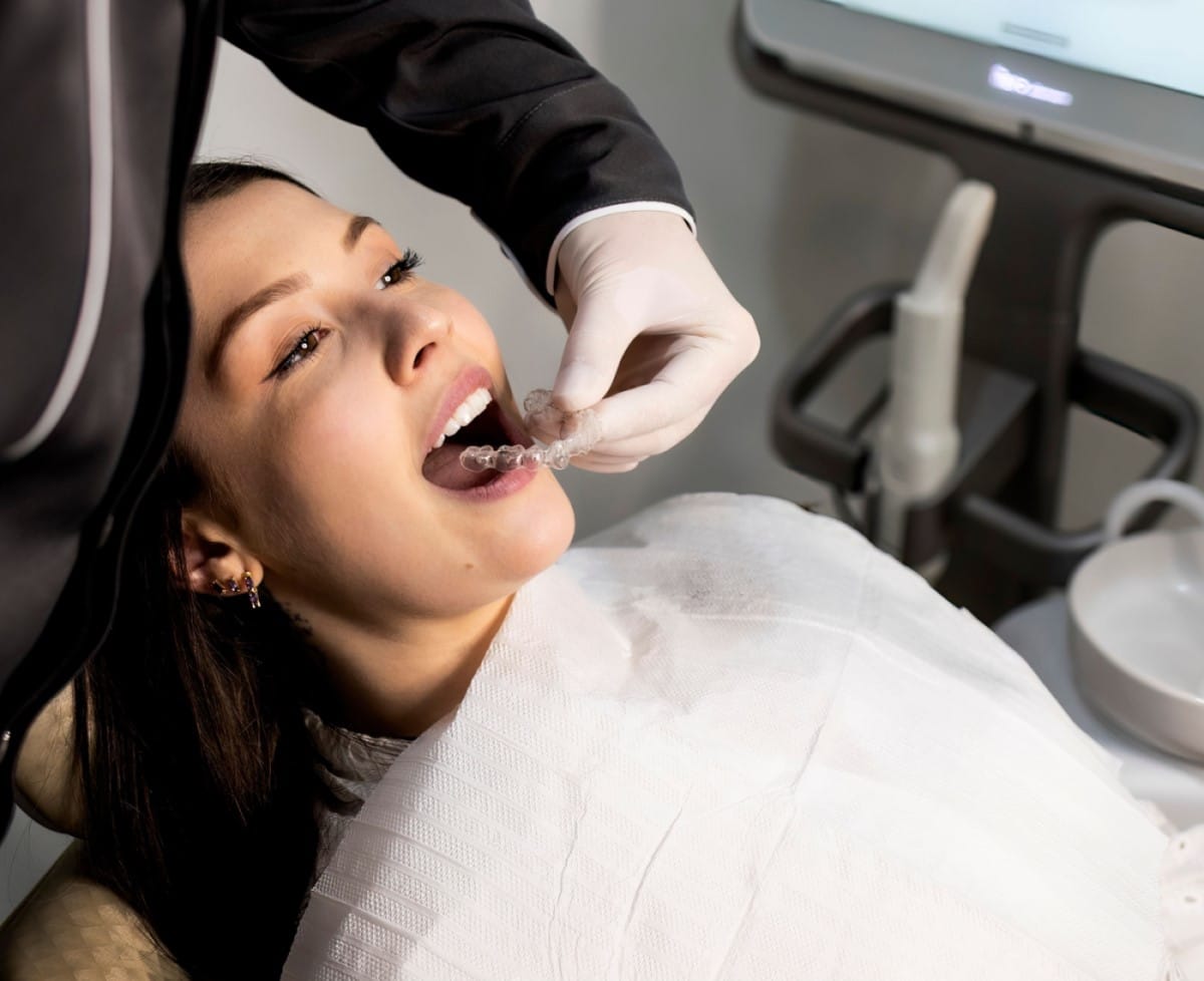 Custom Mouth Guards | DentalX Downsview Dental Clinic